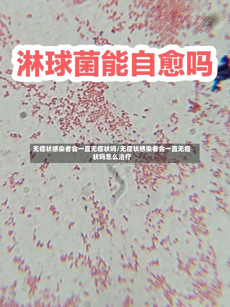 无症状感染者会一直无症状吗/无症状感染者会一直无症状吗怎么治疗