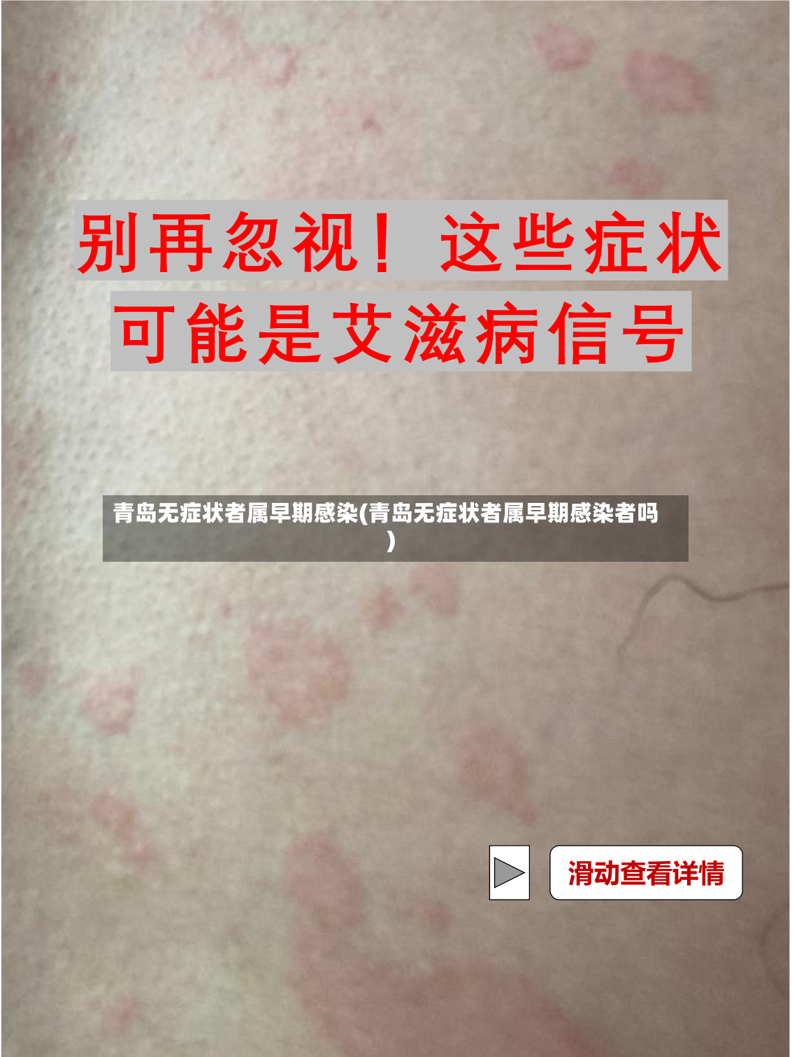 青岛无症状者属早期感染(青岛无症状者属早期感染者吗)-第2张图片