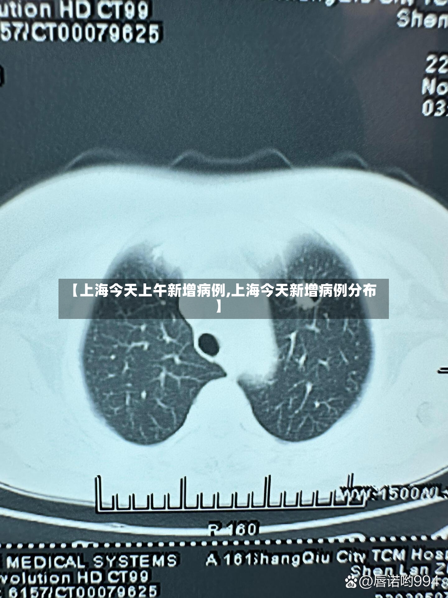 【上海今天上午新增病例,上海今天新增病例分布】