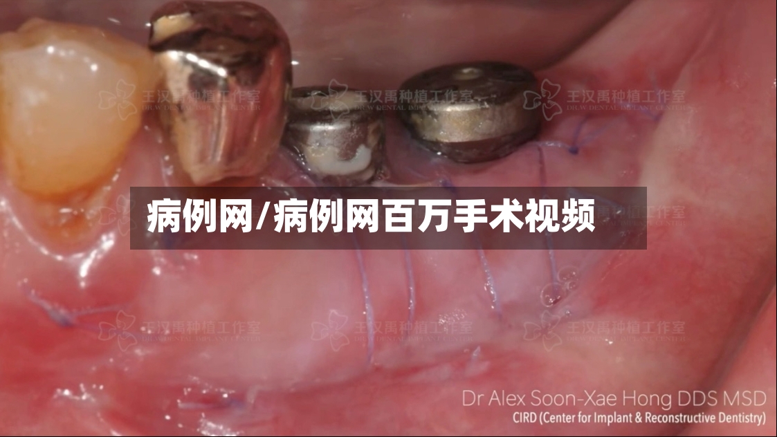 病例网/病例网百万手术视频-第2张图片