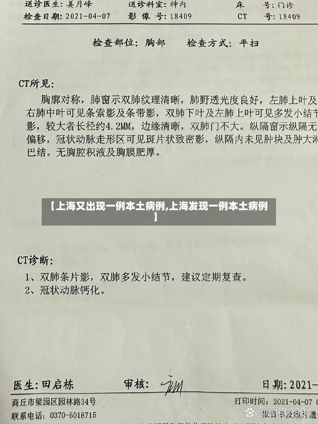 【上海又出现一例本土病例,上海发现一例本土病例】-第3张图片