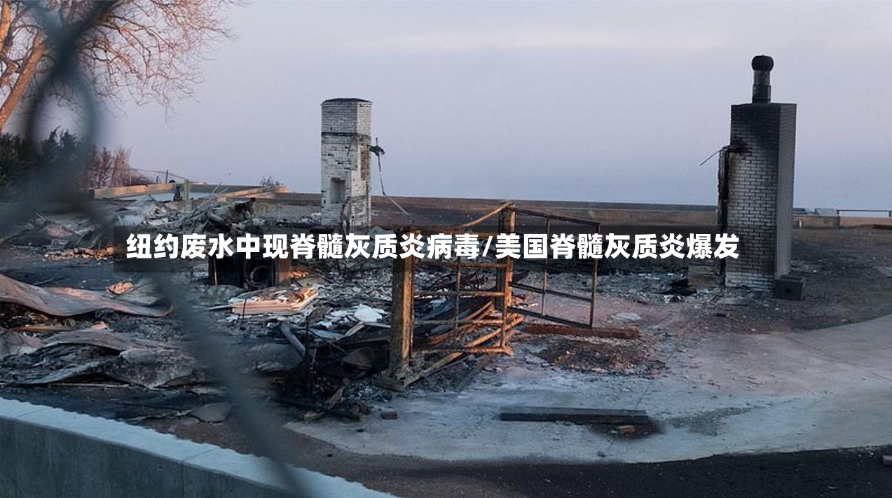 纽约废水中现脊髓灰质炎病毒/美国脊髓灰质炎爆发-第2张图片