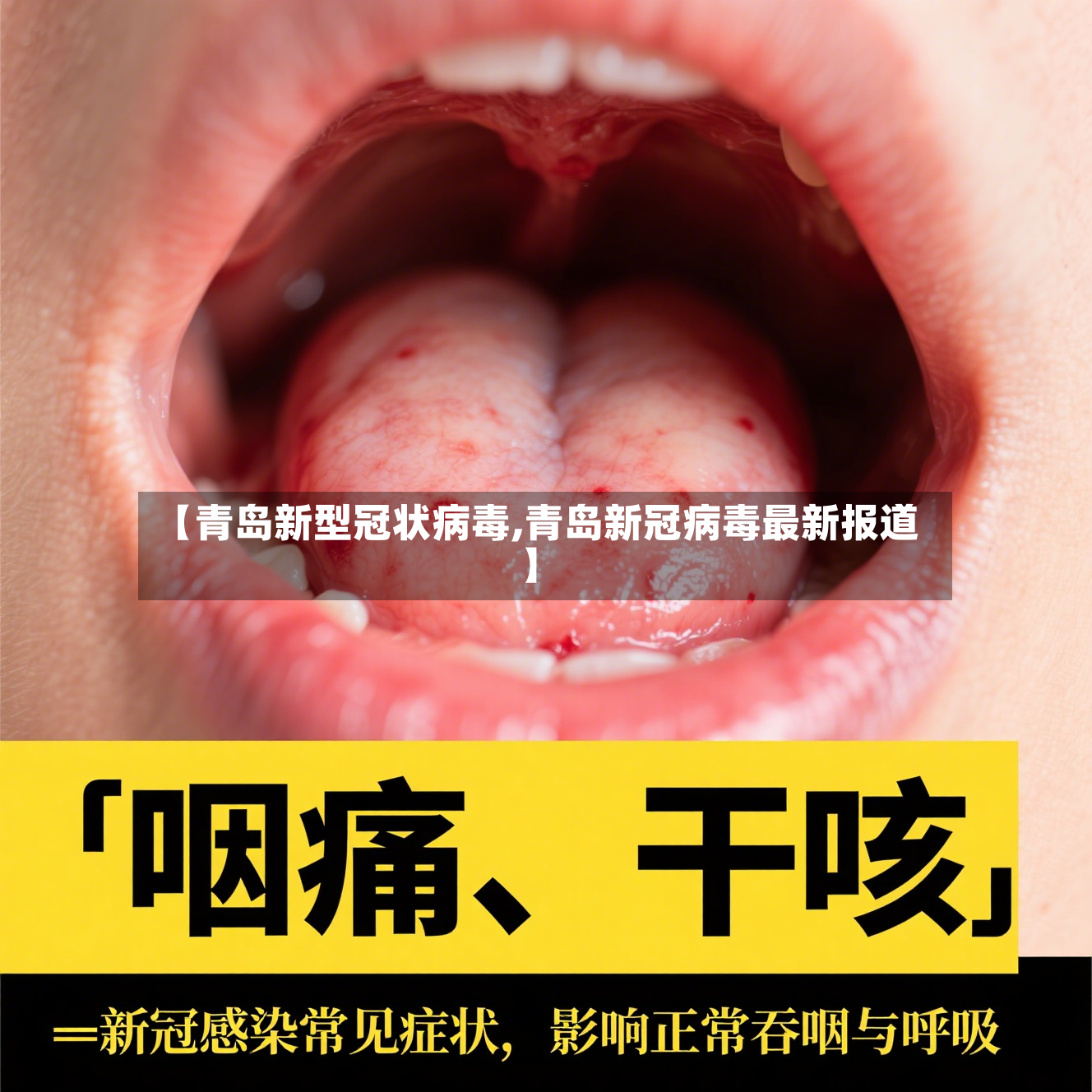 【青岛新型冠状病毒,青岛新冠病毒最新报道】