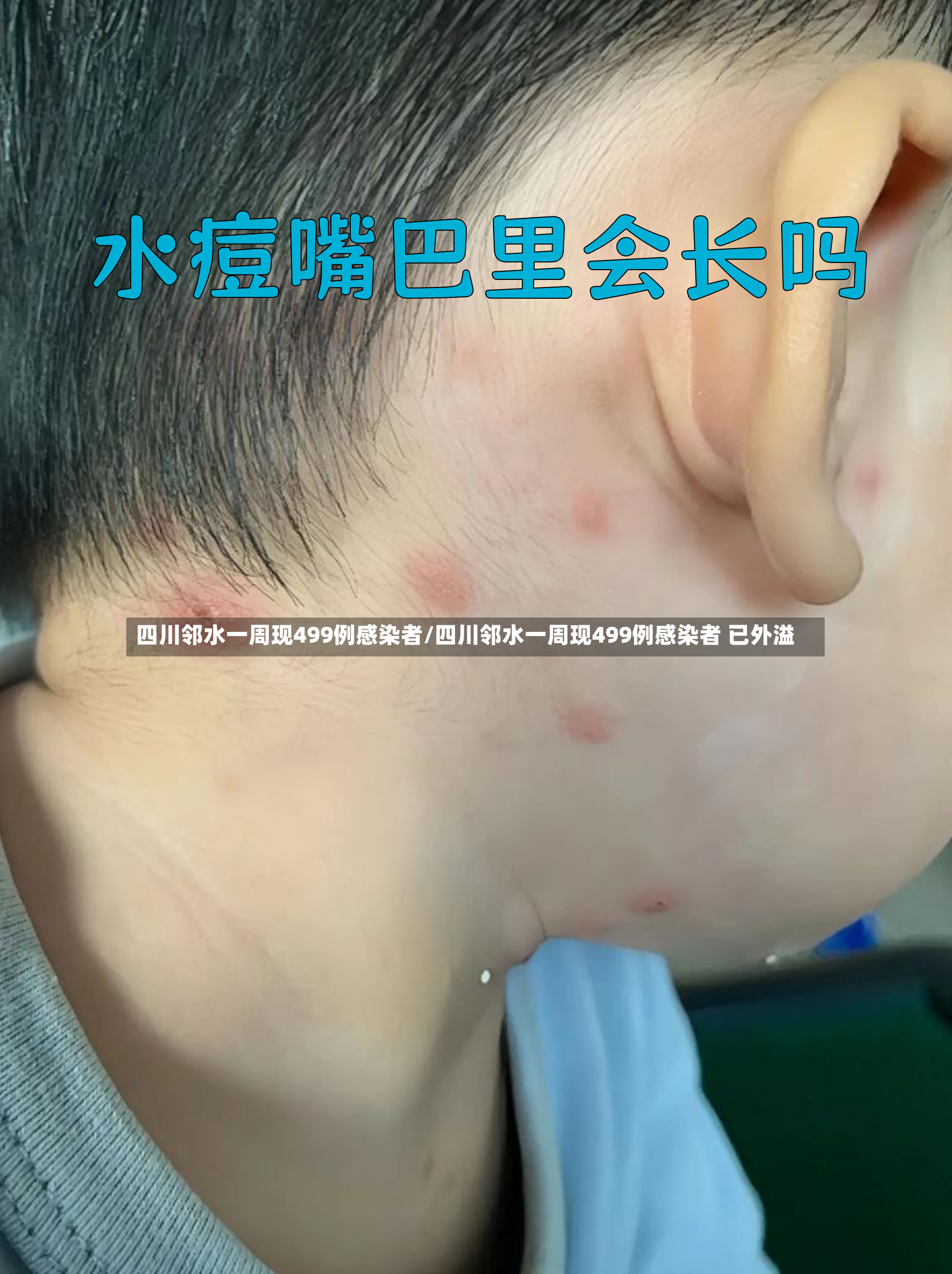 四川邻水一周现499例感染者/四川邻水一周现499例感染者 已外溢