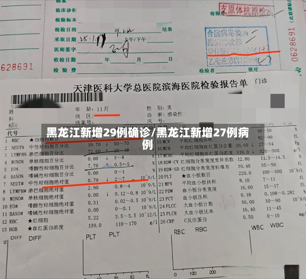 黑龙江新增29例确诊/黑龙江新增27例病例-第3张图片